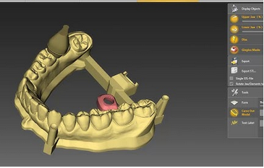 Dental Software Support